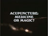 Screenshot for Acupuncture: Medicine or Magic